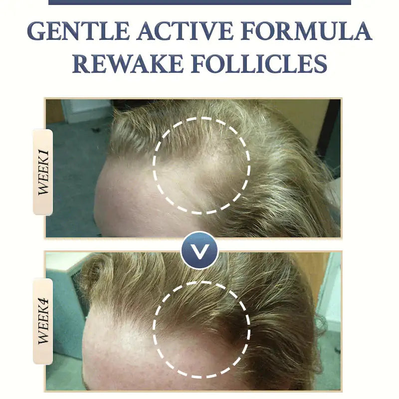 Natural Hair Loss Shampoo