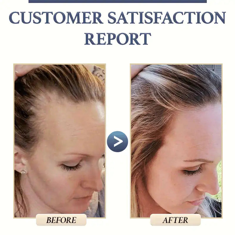 Natural Hair Loss Shampoo